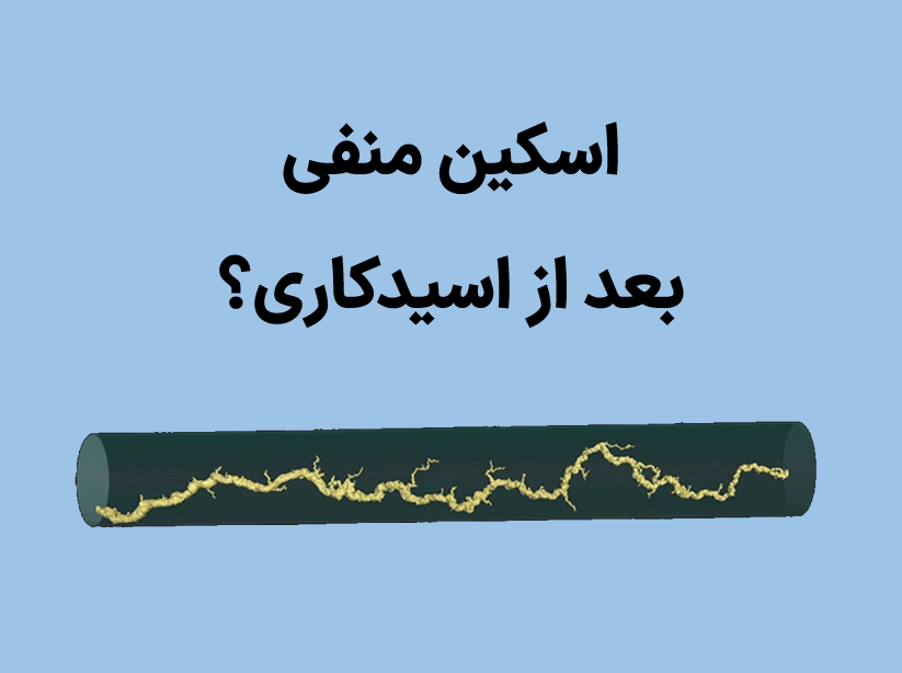 اسکین منفی در اسیدکاری